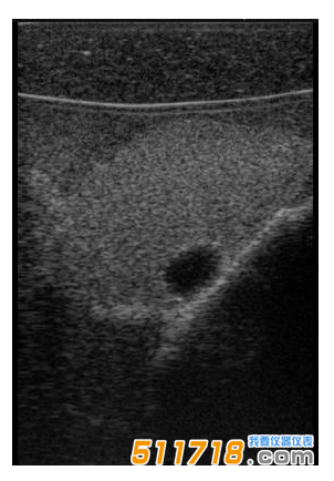 1534992907438311.png 美國(guó)CIRS 074甲狀腺超聲訓(xùn)練模體1.png